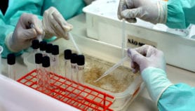 新的血液测试以检测巴西批准的寨卡病毒
